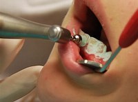 20 - Why You Should Choose a Private Dentist Seaton