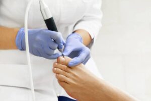 flat feet orthotics Adelaide